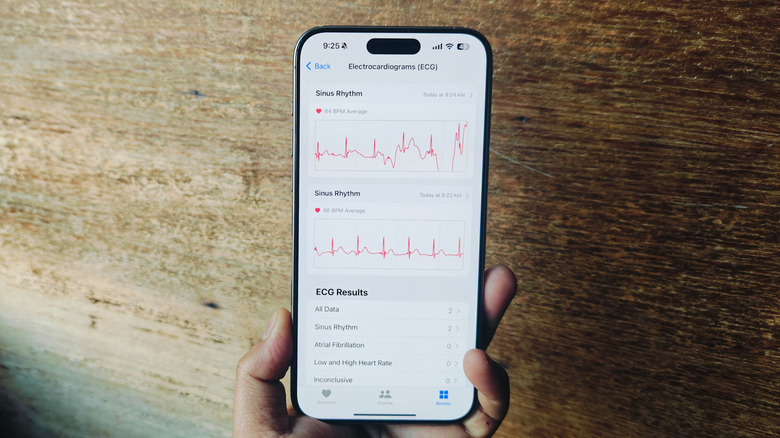 ECG waveform on Apple Watch. 